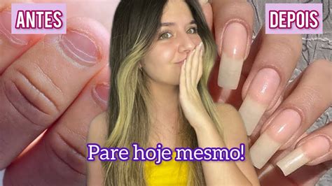 COMO PARAR DE ROER AS UNHAS RÁPIDO unhas dicas tutorial YouTube