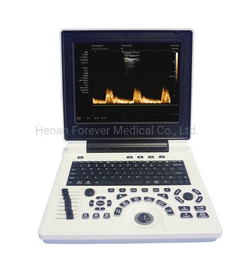 Portable Ultrasound Scanner Digital Ultrasonic Diagnostic System