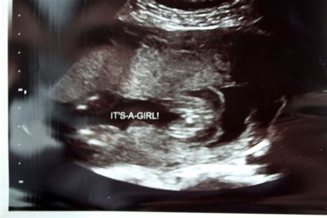 Fowle Family Adventures: 21 Weeks and Ultrasound!