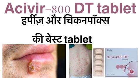 Acivir 800 Dt Tablet Uses In Hindi Aciclovir 800 Dt Tablet Uses In