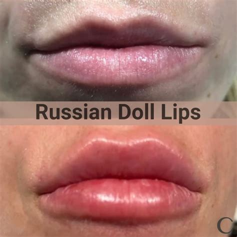 Baby Doll Lips Filler Lipstutorial Org