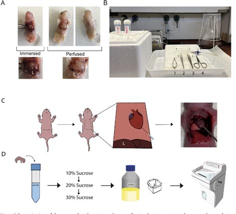 Figure From Trans Cardiac Perfusion Of Neonatal Mice And