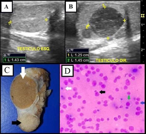 A Ultrasonographic Image Of Left Testis Longitudinal Section With Download Scientific