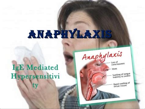 Anaphylaxis Ige Mediated Hypersensitivity