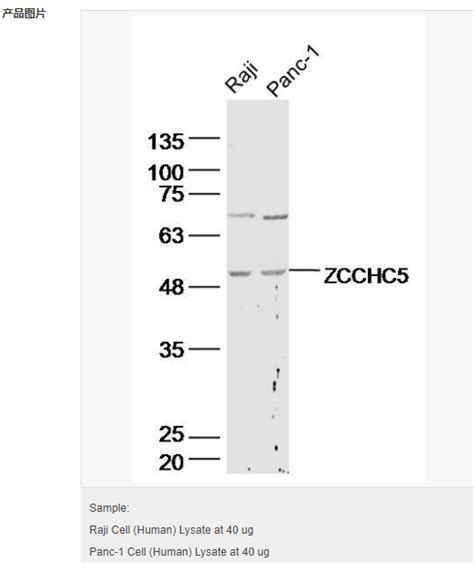 Zcchc5蛋白抗体 北京拜尔迪生物技术有限公司