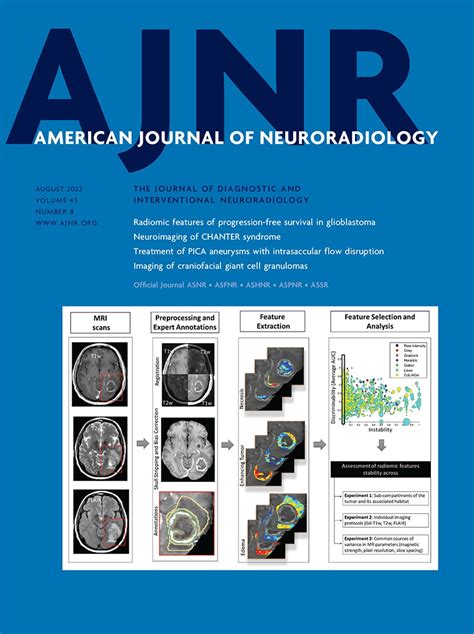 Deep Learning For Synthetic Ct From Bone Mri In The Head And Neck