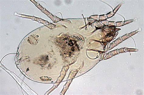 Dermatofagoide Pternyssinus Scheda Tecnica Allergeni Dermatophagoides