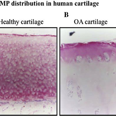 Pdf Cartilage Oligomeric Matrix Protein And Its Binding Partners In