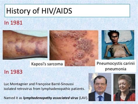 Aids And Hiv