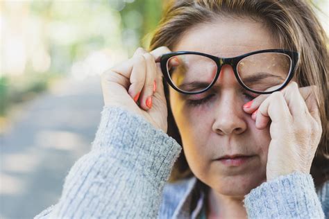 19 Enfermedades Comunes En Los Párpados Y Su Tratamiento Mejor Con Salud