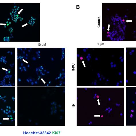 Representative Photomicrographs Of Mcf 7 Cell Line After A Download Scientific Diagram