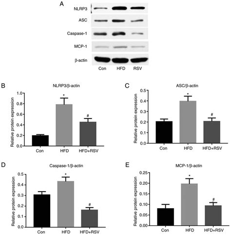 Effect Of Rsv Administration On The Protein Expression Levels Of Mcp