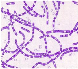 Bacillus And Listeria Flashcards Quizlet