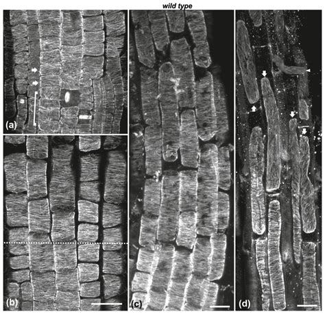 Cortical Microtubule Orientation At The External Cell Faces Of