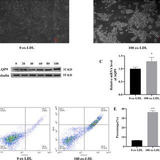 Ox Ldl Induced Aqp And Cell Apoptosis In Huvecs A Cells Were Treated