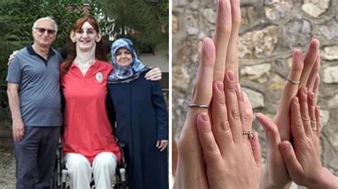 Rumeysa Gelgi The Worlds Tallest Woman Sets Three New Guinness World