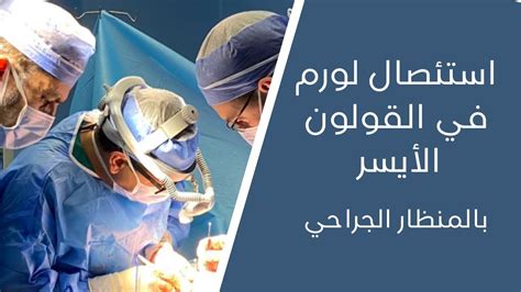 استئصال لورم في القولون الأيسر I Laparoscopic Left Hemicolectomy Youtube