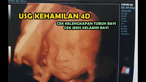 USG 4D 26 MINGGU CEK KEHAMILAN 4 DIMENSI YouTube