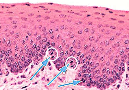 A lâmina abaixo é um corte histológico do tecido epitelial Observe a