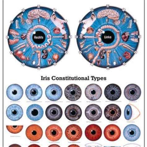 Iris Diagnosis Chart