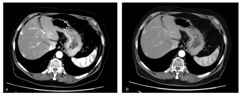 Applied Sciences Free Full Text Dual Energy Ct Applications In