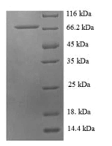 Enquirebio Recombinant Human Probable Histidine Trna Ligase