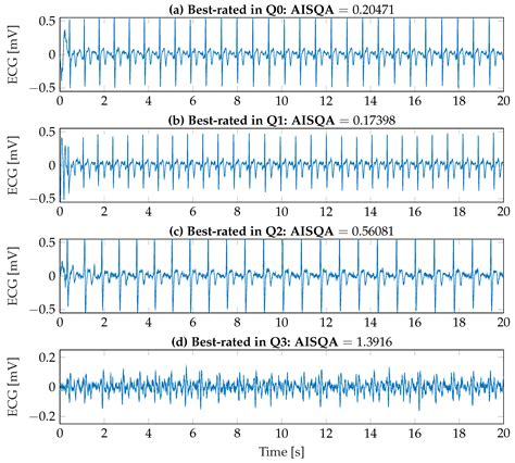 Sensors Free Full Text Automated Signal Quality Assessment Of Single Lead Ecg Recordings For