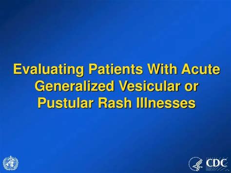 Ppt Evaluating Patients With Acute Generalized Vesicular Or Pustular Rash Illnesses Powerpoint