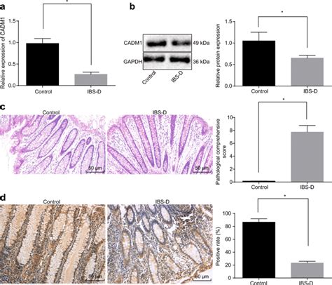 Cadm Is Down Regulated In Ibs D Rats A Mrna Expression Of Cadm In