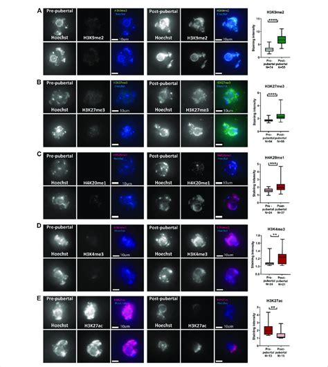 Histone Post Translational Modifications Pattern Changes During