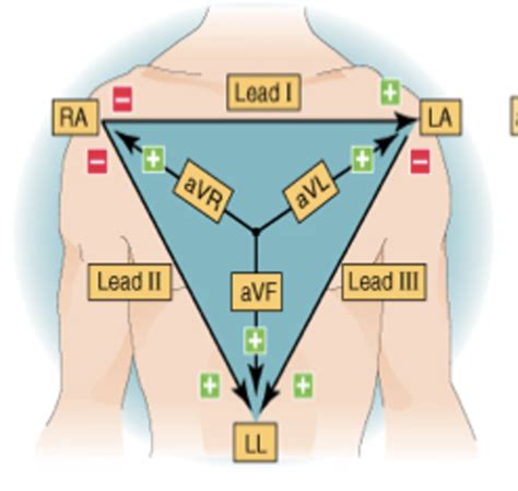 Ekg Flashcards Quizlet