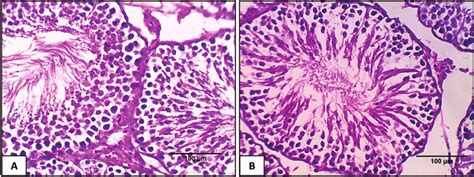 Sections From Testicular Tissue A Control Group Showing Normal