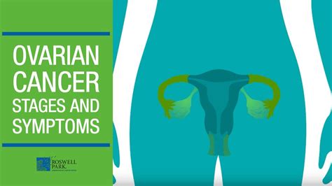 Understanding Ovarian Cancer Stages and Symptoms – Breast Cancer Daily