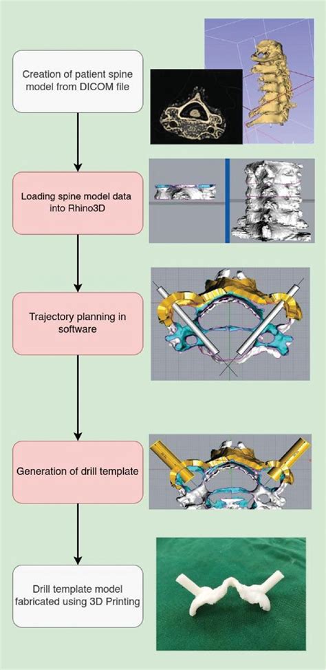 Figure 1 From Low Cost 3D Modeling Software For Generating Patient