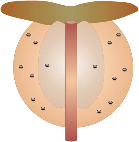 14-Fragments in a random biopsy pattern (coronal view, black dots... | Download Scientific Diagram