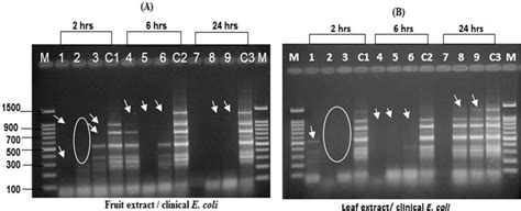 Eric Pcr Profile Of Clinical E Coli Strain Treated And Untreated With