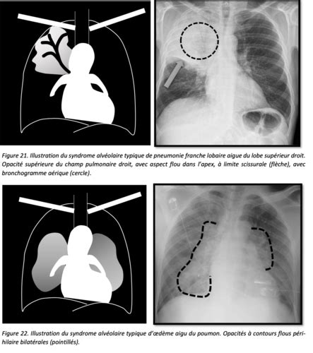 Radiologie Cartes Quizlet