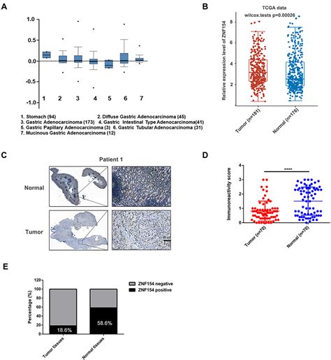 Low Expression Of ZNF154 And Gastric Cancer CMAR