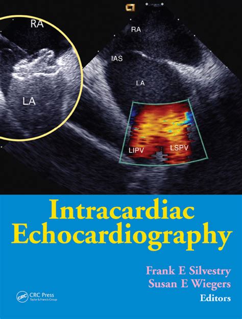 Intracardiac Echocardiography eBook – eBookuno.com