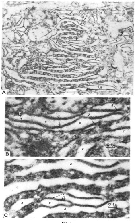 Figure 3 From The Electron Microscopy Of The Golgi Apparatusin The