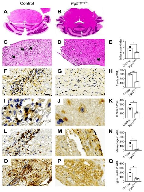 Inflammation And Immune Cell Infiltration In The Cerebellum At Day 62