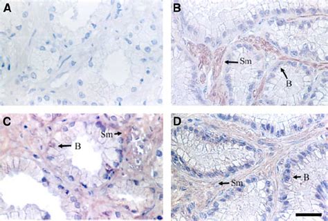 Immunohistochemical Analysis Of Ngf B And Its Receptors Trka C