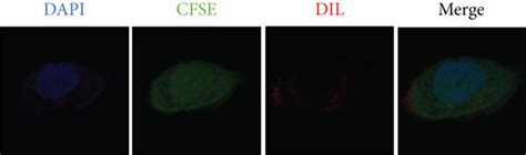 The Effect Of HUMSC SEVs On HCECs Proliferation And Migration In