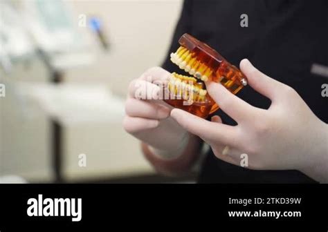 Dentist With Latex Gloves Holding Human Jaws Model With Installed Metal