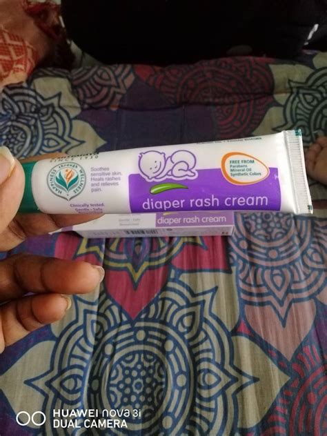 Best Diaper Rash Cream In India A Complete Guide Atelier Yuwa Ciao Jp