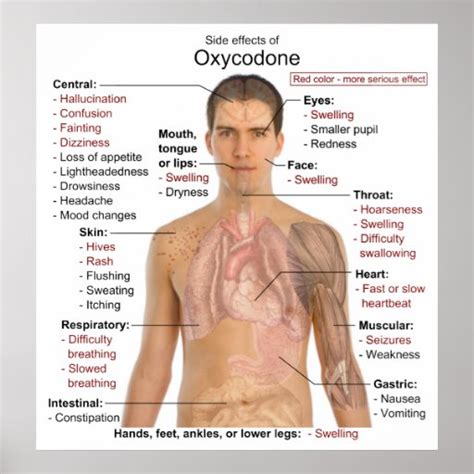 Chart Of The Main Side Effects Of Oxycodone Poster Zazzle