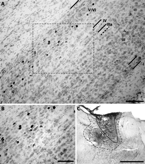 Multiform Cells In Pos Layers V Vi Labeled By Bda Injection Into Adn