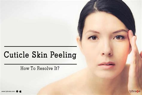 Cuticle Skin Peeling How To Resolve It By Dr Shruti Agarwal Lybrate