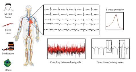 ECG Signal Analysis Institute Of Signal Processing