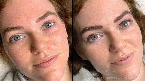 Permanent Makeup Before And After Care Mugeek Vidalondon